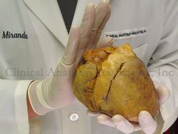 Human heart - Cardiac base