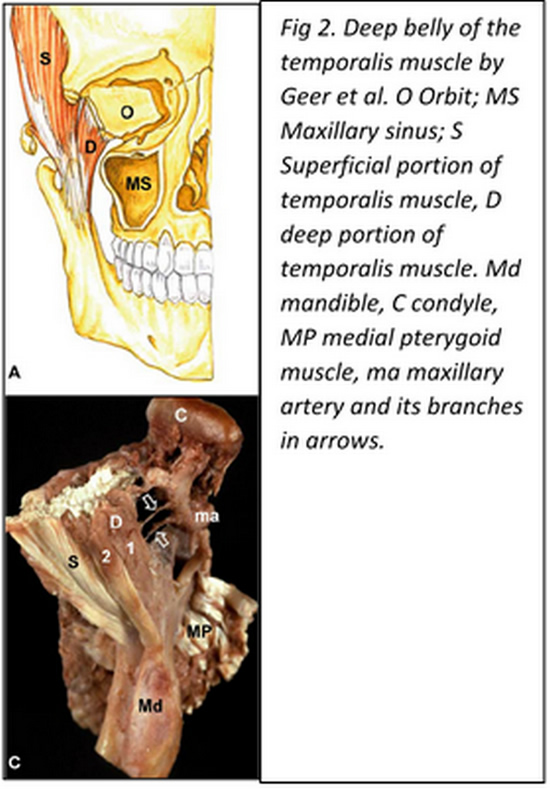 Muscle temporal (crotaphyte) : définition, rôle, schéma