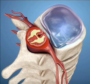Spinal cord image WRONG!