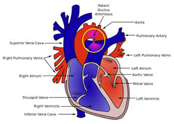 Four chamber section of the heart. By BrownCow. [Public domain], from Wikimedia Commons