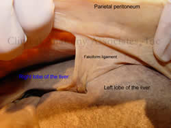 Falciform ligament