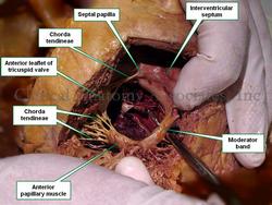 Interior of the right ventricle - Human heart