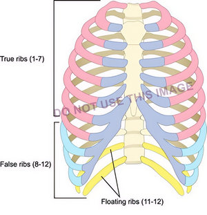 An example of wrong labeling of an image