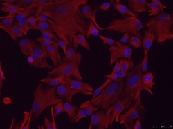 Murine somatic cells of mesenchymal origin. Image courtesy of Dr. O'Garcia