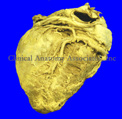 Posterior (inferior) view of a heart